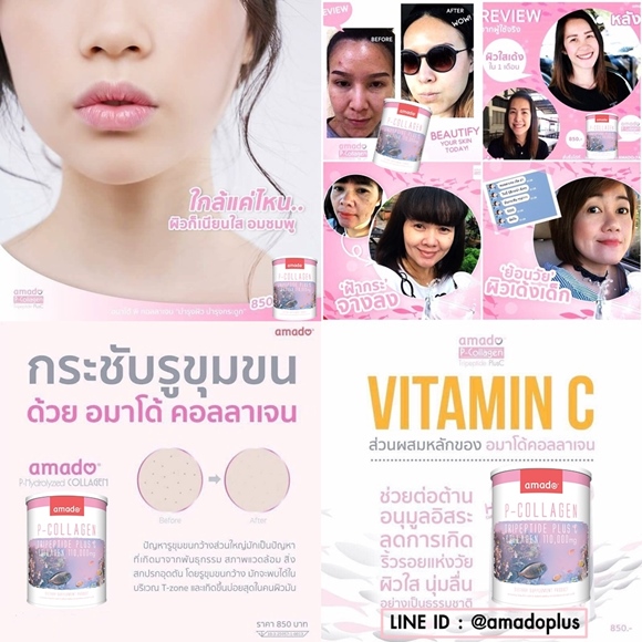 review-amado-collagen-บำรุงข้อเข่าเสื่อม