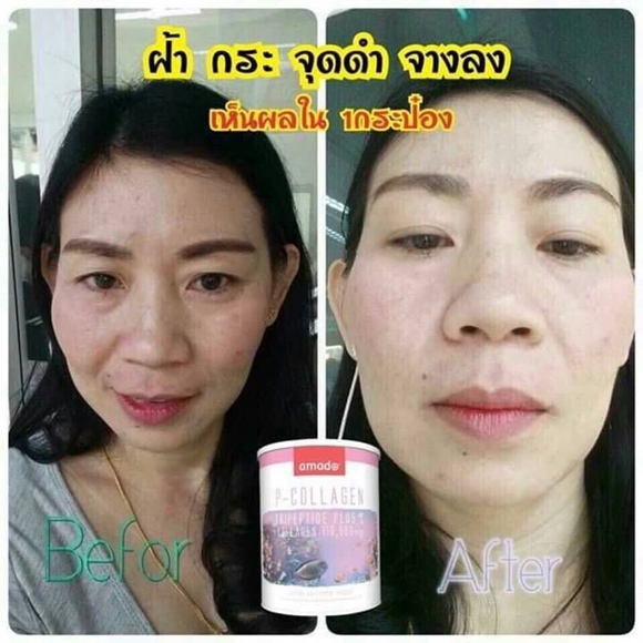 review-amado-collagen-หน้าขาวใส