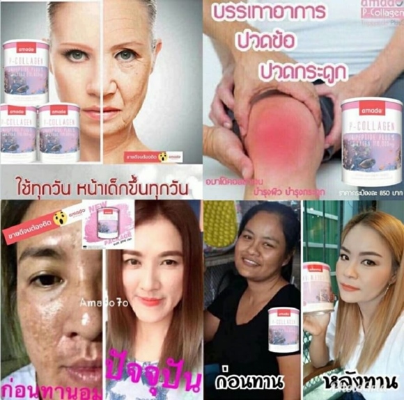 review-amado-collagen-หน้าสิวผิวขาวใส