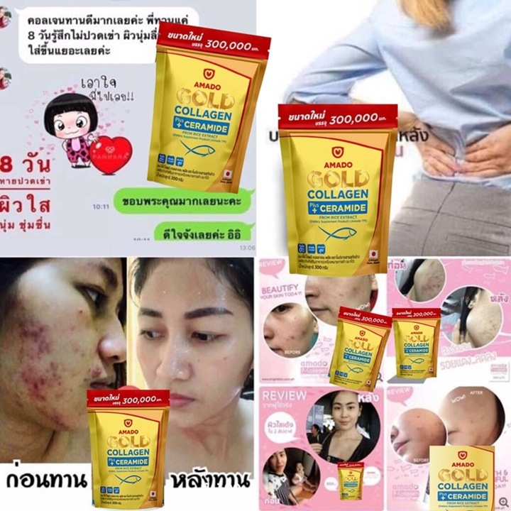 Gold-Collagen-Amadoผิวขาวใส