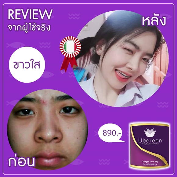 Review Ubereen-Collagen ผิวขาว