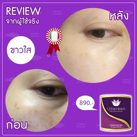Review Ubereen Collagen ลดฝ้ากระ